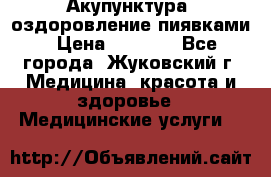 Акупунктура, оздоровление пиявками › Цена ­ 3 000 - Все города, Жуковский г. Медицина, красота и здоровье » Медицинские услуги   